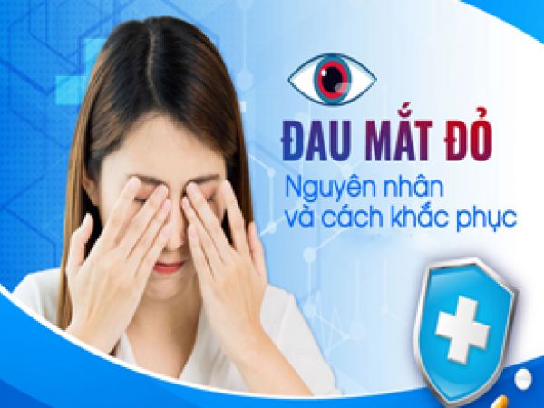ĐAU MẮT ĐỎ: NGUYÊN NHÂN, TRIỆU CHỨNG, CÁCH ĐIỀU TRỊ VÀ PHÒNG NGỪA