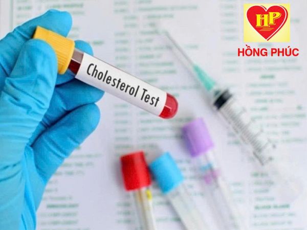 TẦM SOÁT RỐI LOẠN MỠ MÁU – PHÁT HIỆN SỚM, PHÒNG NGỪA BIẾN CHỨNG TIM MẠCH!
